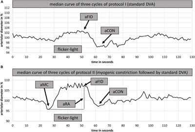 Quantification of Retinal Vessel Myogenic Constriction in Response to Blood Pressure Peaks: Implications for Flicker Light-Induced Dilatation